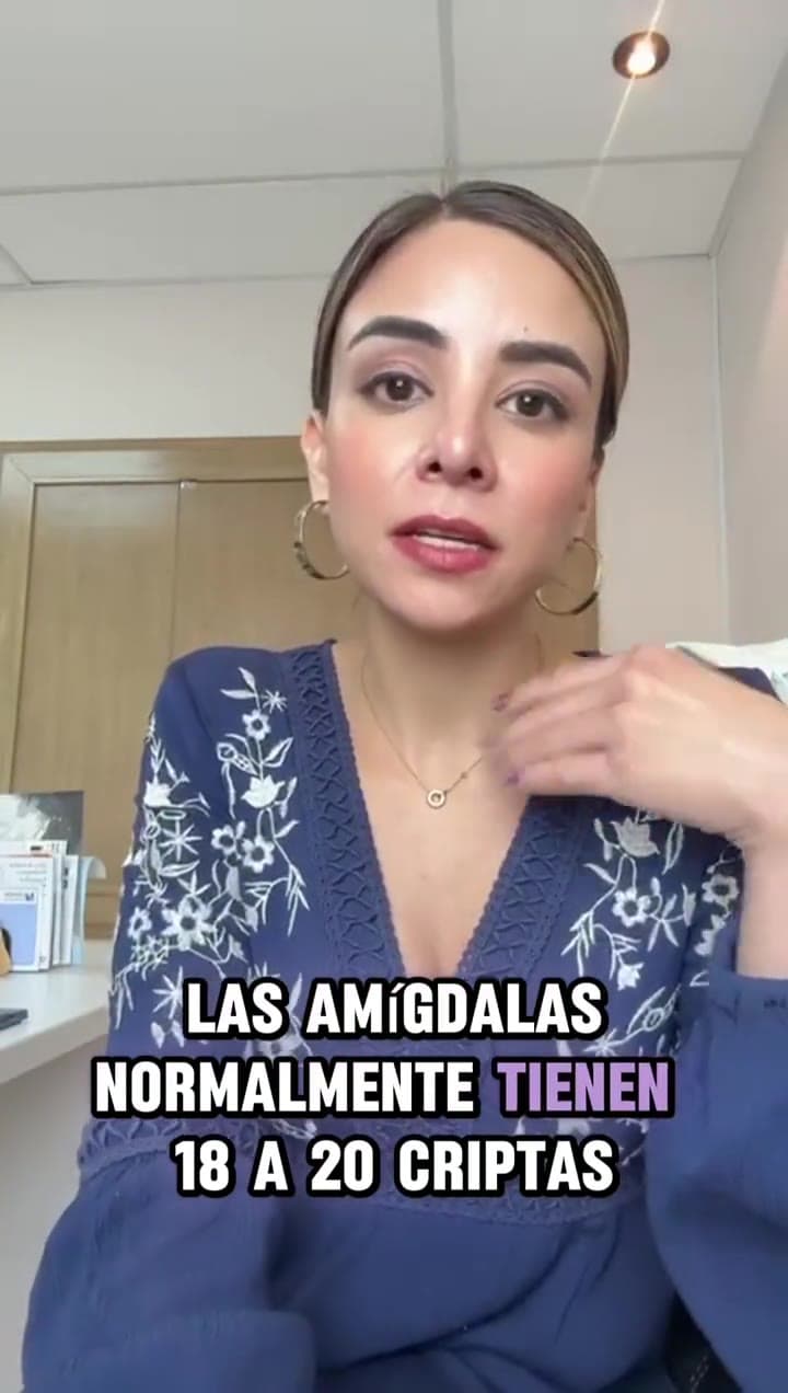 Amigdalitis caseosa: los puntos blancos